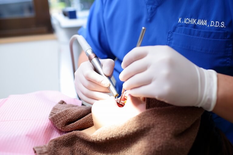 歯周病の治療後のメンテナンス